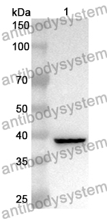 Anti-Human AKR1C3 Polyclonal Antibody