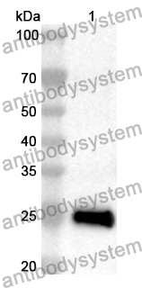 Anti-DPP6 Polyclonal Antibody