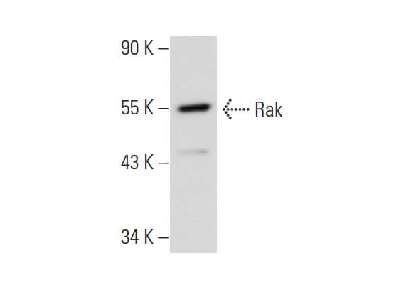 Anti-FRK Polyclonal Antibody