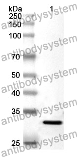 Anti-FRK Polyclonal Antibody