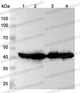 Anti-ACAA2 Polyclonal Antibody