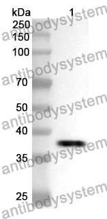 Anti-WAS Polyclonal Antibody