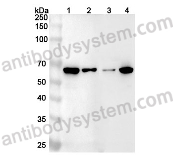 Anti-WAS Polyclonal Antibody