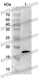 Anti-Human CDKN2A/p16INK4a Polyclonal Antibody