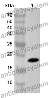 Anti-Human CXCL5/ENA-78 Polyclonal Antibody