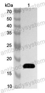 Anti-Human HTT Polyclonal Antibody