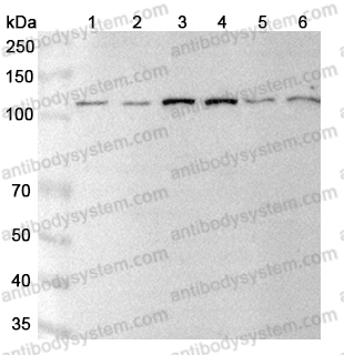 Anti-ECE1 Polyclonal Antibody