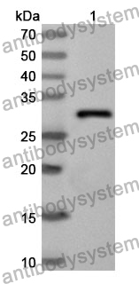 Anti-CD146/MCAM Polyclonal Antibody