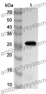 Anti-CTSK Polyclonal Antibody