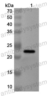 Anti-Human MATR3 Polyclonal Antibody