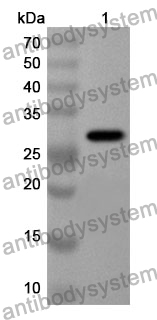 Anti-BTD Polyclonal Antibody