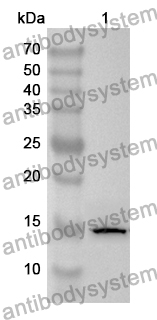 Anti-Human SSR2 Polyclonal Antibody