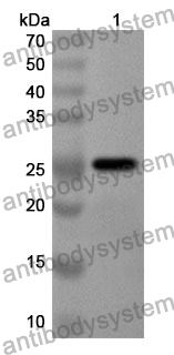 Anti-CRYBB2 Polyclonal Antibody