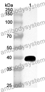 Anti-NR4A2 Polyclonal Antibody