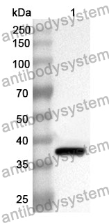 Anti-MAGEA11 Polyclonal Antibody