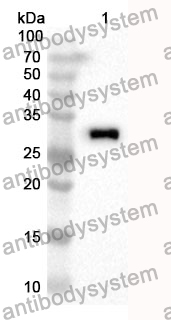 Anti-ZAP70 Polyclonal Antibody