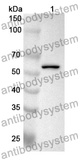 Anti-NAMPT Polyclonal Antibody