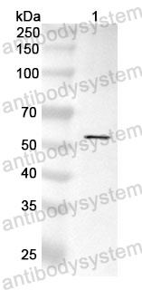 Anti-CD158j/KIR2DS2 Polyclonal Antibody