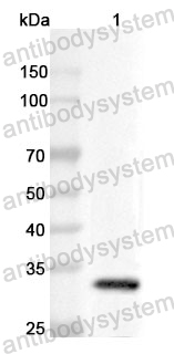 Anti-CD158i/KIR2DS4 Polyclonal Antibody