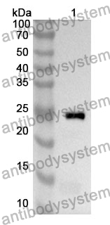 Anti-CHRNA4 Polyclonal Antibody