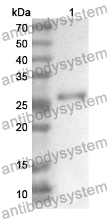 Anti-Human TNNT2 Polyclonal Antibody