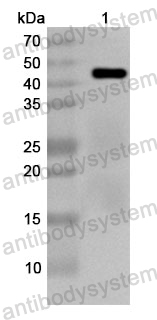 Anti-Human ACADSB Polyclonal Antibody