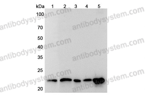 Anti-Human CBX5 Polyclonal Antibody