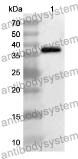 Anti-MAPK9 Polyclonal Antibody