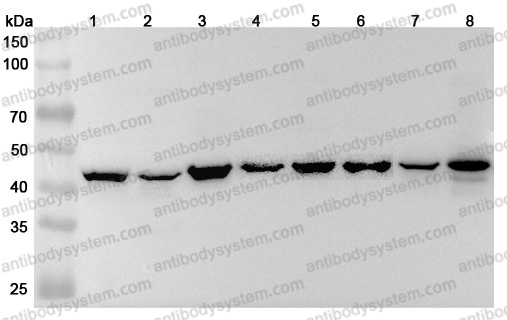 Anti-Human MAP2K4 Polyclonal Antibody