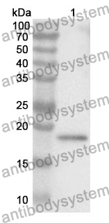 Anti-Ki67/MKI67 Polyclonal Antibody