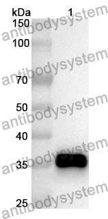 Anti-CCR10 Polyclonal Antibody