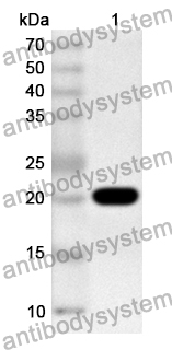 Anti-NSF Polyclonal Antibody