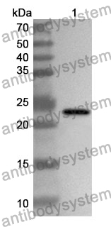 Anti-CDKN1B Polyclonal Antibody