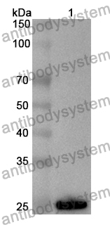 Anti-Human RPL5 Polyclonal Antibody