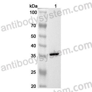 Anti-Human GNPDA1 Polyclonal Antibody