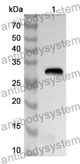 Anti-UTRN Polyclonal Antibody