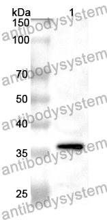 Anti-GYG1 Polyclonal Antibody