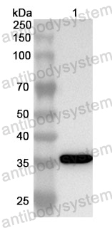 Anti-Human CAPZA2 Polyclonal Antibody