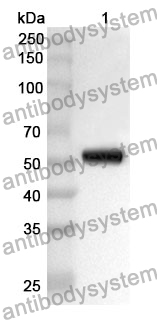 Anti-GABRA2 Polyclonal Antibody