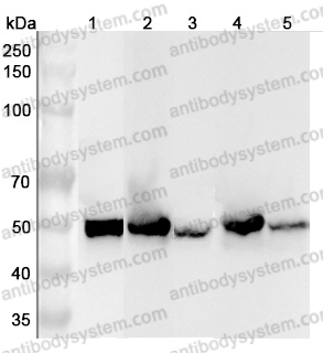 Anti-Human ALDH1A3 Polyclonal Antibody