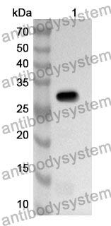 Anti-NPTX2 Polyclonal Antibody