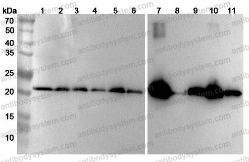 Anti-Human UQCRFS1 Polyclonal Antibody