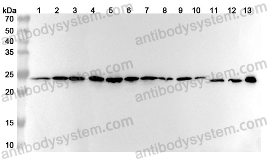 Anti-Human ATP5PO Polyclonal Antibody