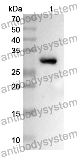 Anti-LIMS1 Polyclonal Antibody