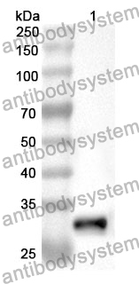 Anti-IREB2 Polyclonal Antibody