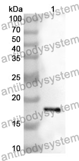 Anti-REG1B Polyclonal Antibody