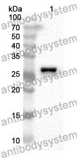 Anti-TFPI2 Polyclonal Antibody