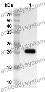 Anti-LSS Polyclonal Antibody