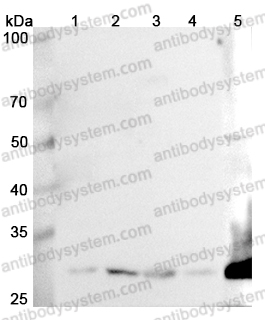 Anti-GCLM Polyclonal Antibody