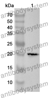 Anti-Human PCP4 Polyclonal Antibody